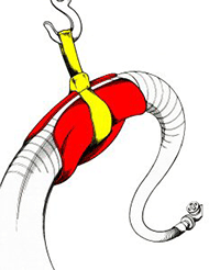 large bore hosebun